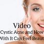 what is cystic acne