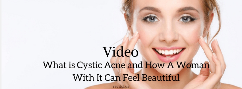 what is cystic acne