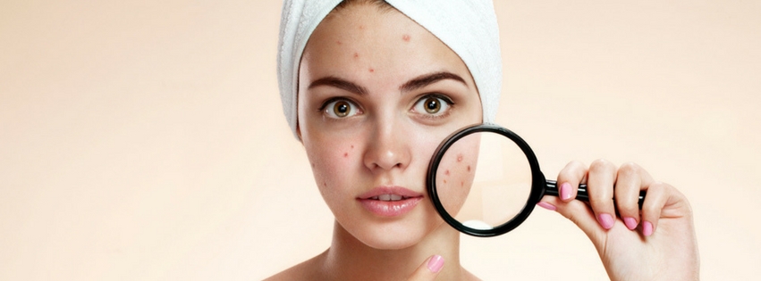 Making Your Acne Worse
