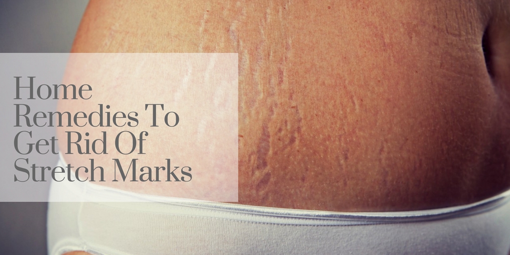 Stretch Mark Removal