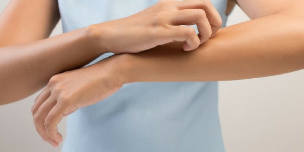 Skin Allergy
