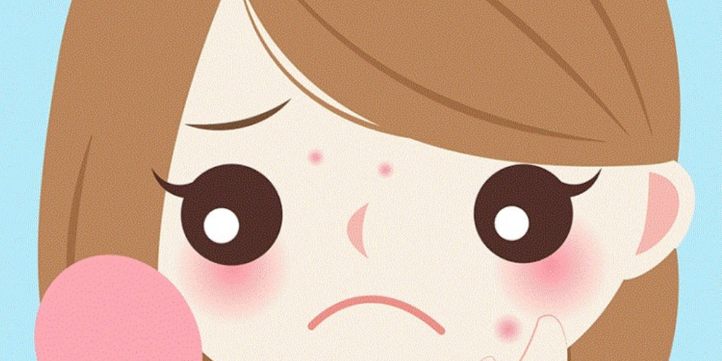 Pimples