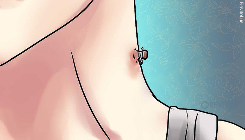 Tips To Getting Rid Of Skin Tags