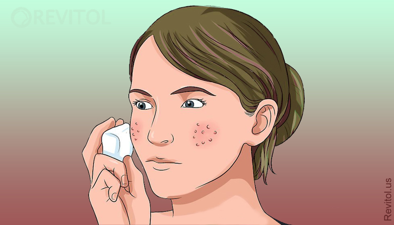 Reduce Pores On Face naturally