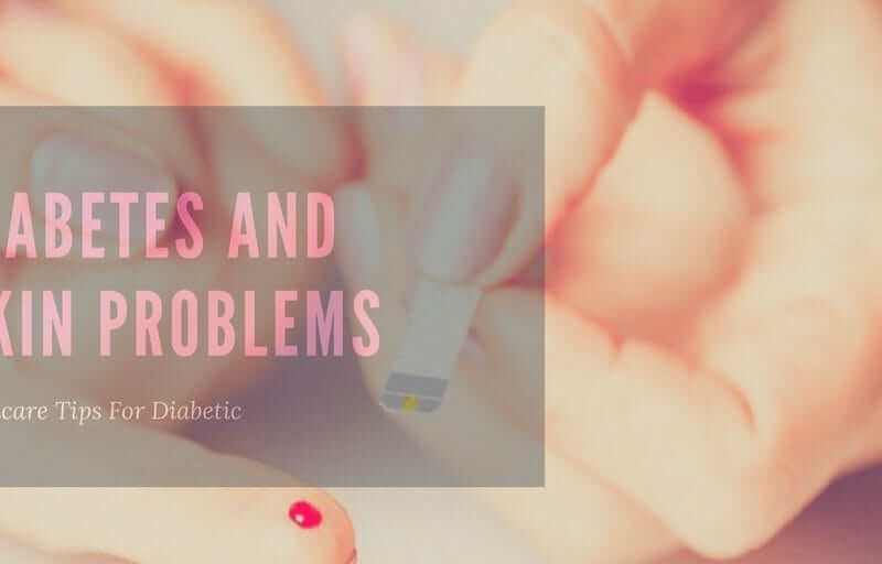 Diabetes-And-Skin-Problems