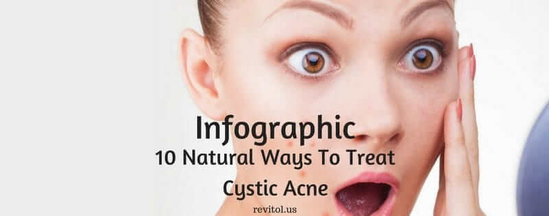 natural-ways-to-treat-cystic-acne